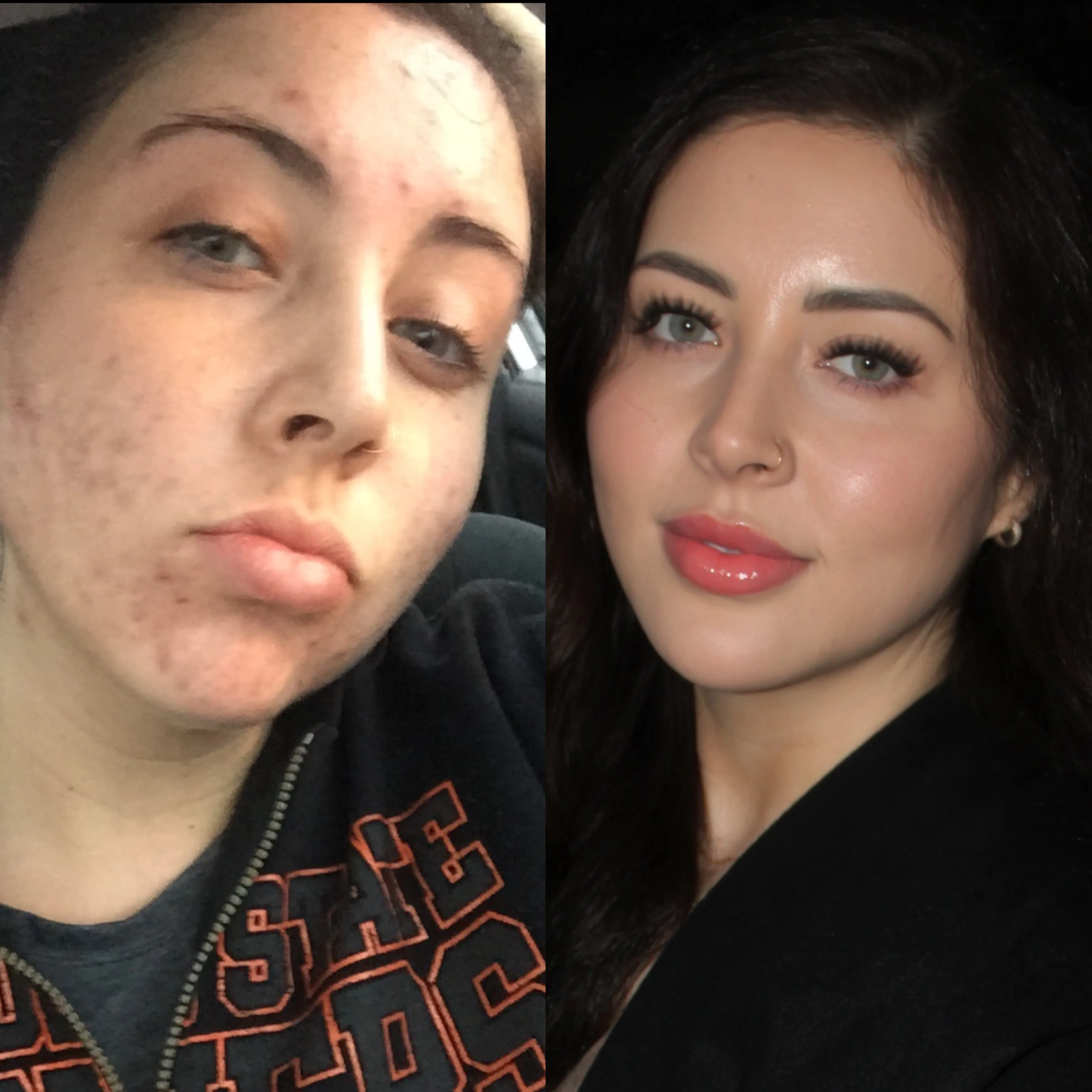 From Patient to Provider: My Journey in Aesthetics