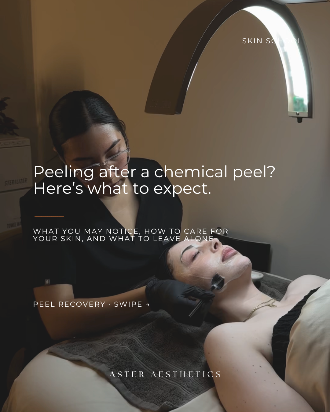 Chemical Peel Recovery Day by Day | Aster Aesthetics
