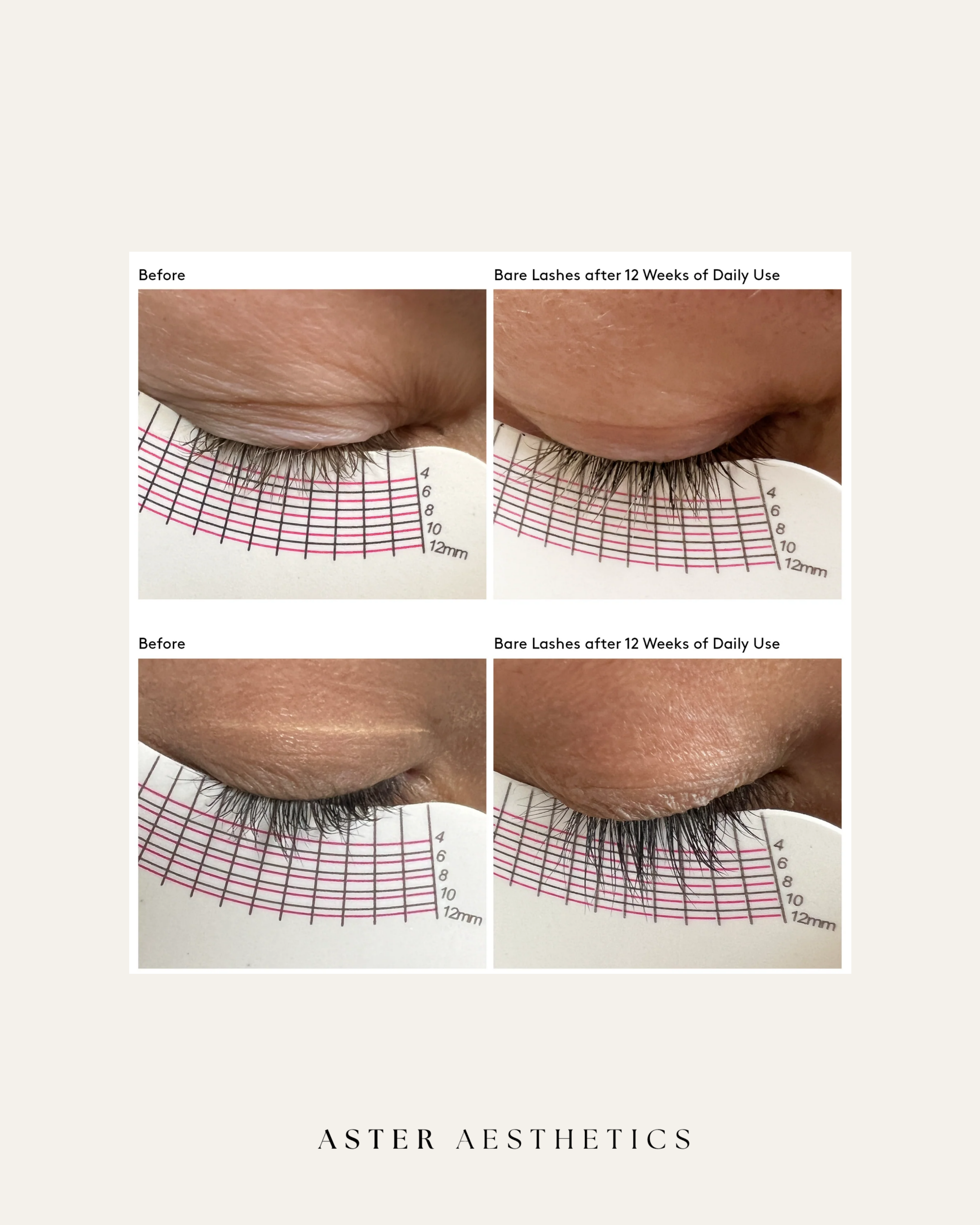 Copy of Beige Minimalist Beauty and Skincare Product Instagram Story   3