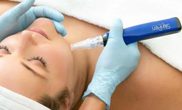 Peels and Microneedling