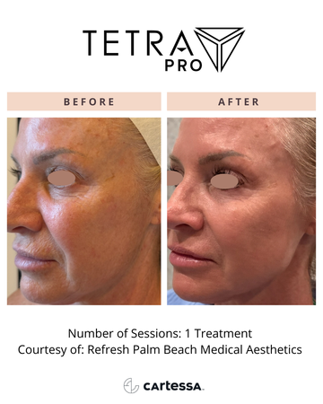 Tetra Pr O119175553141559