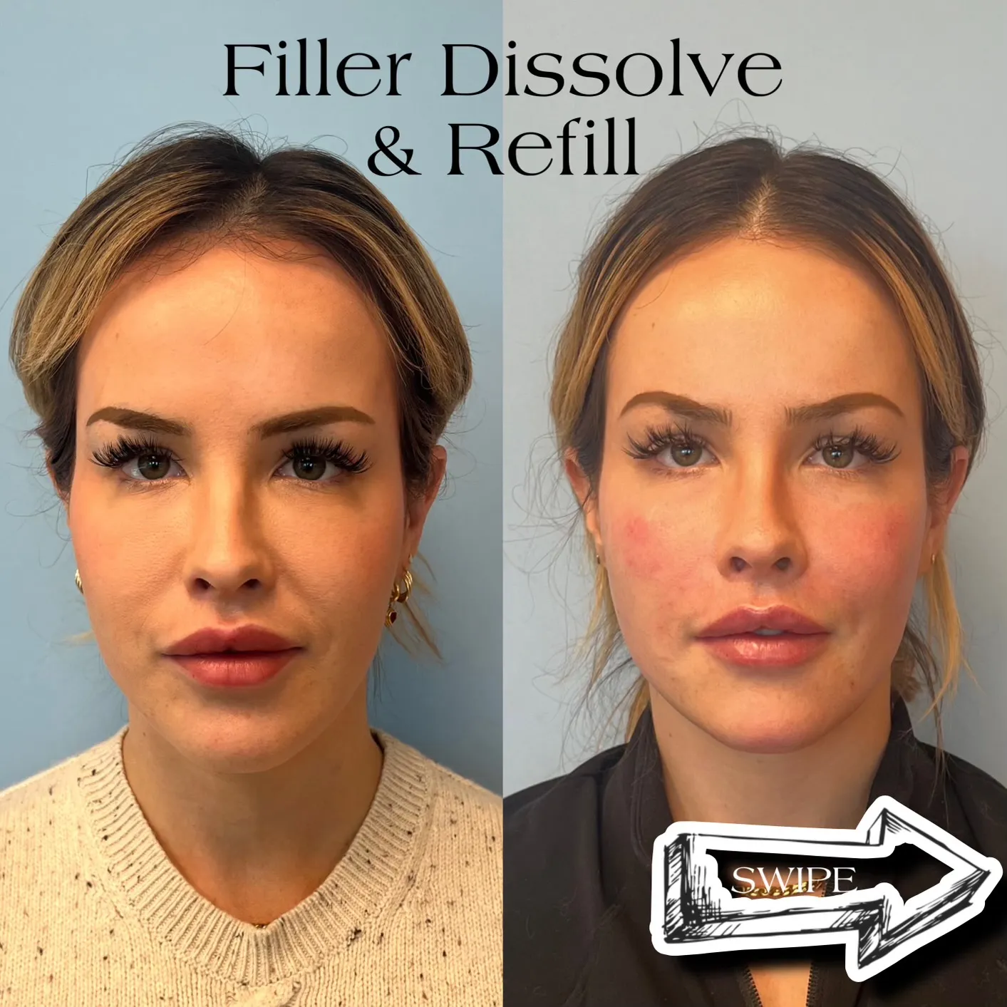 The Power of Precision: A Journey to Natural, Undetectable Results