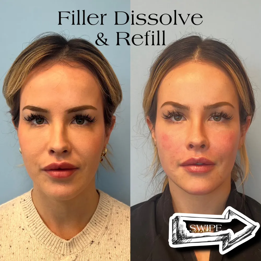 The Power of Precision: A Journey to Natural, Undetectable Results