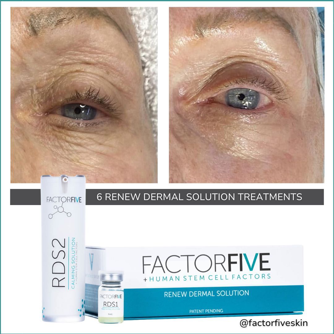 Copy of Ff Left Eye Mktg Post