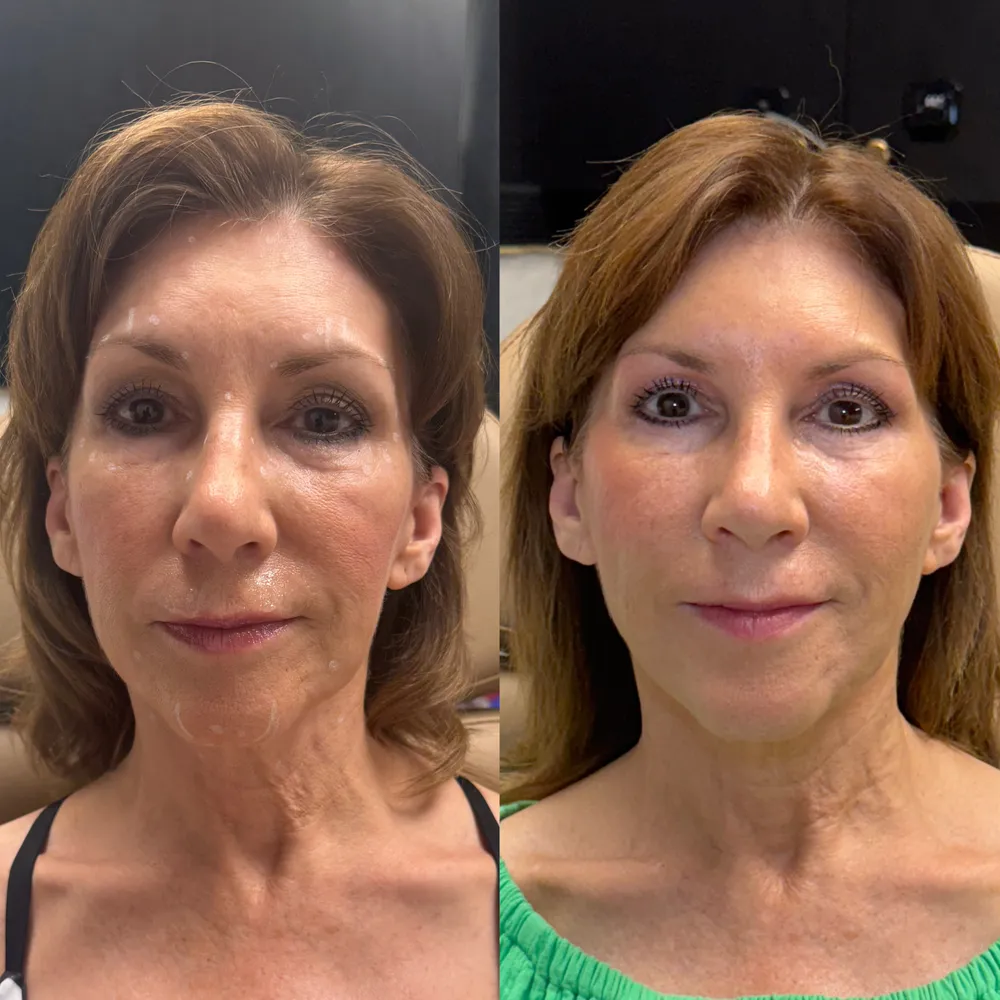 Why a Multimodal Approach is the Secret to Timeless, Natural Aesthetics