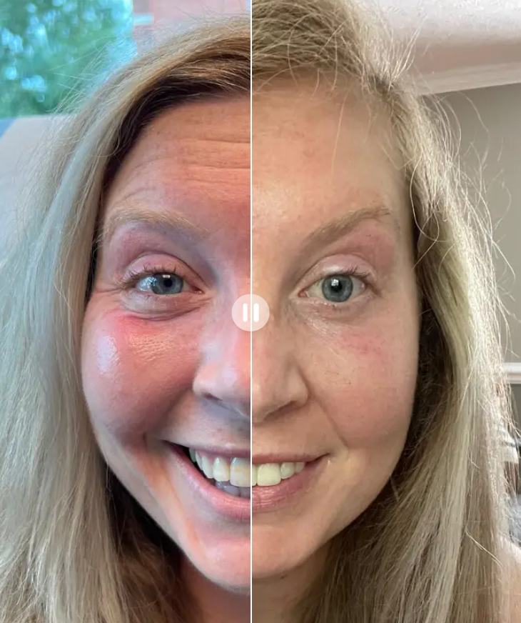 foil・Aesthetic Consultation UF - Curious about non-surgical treatments but unsure where