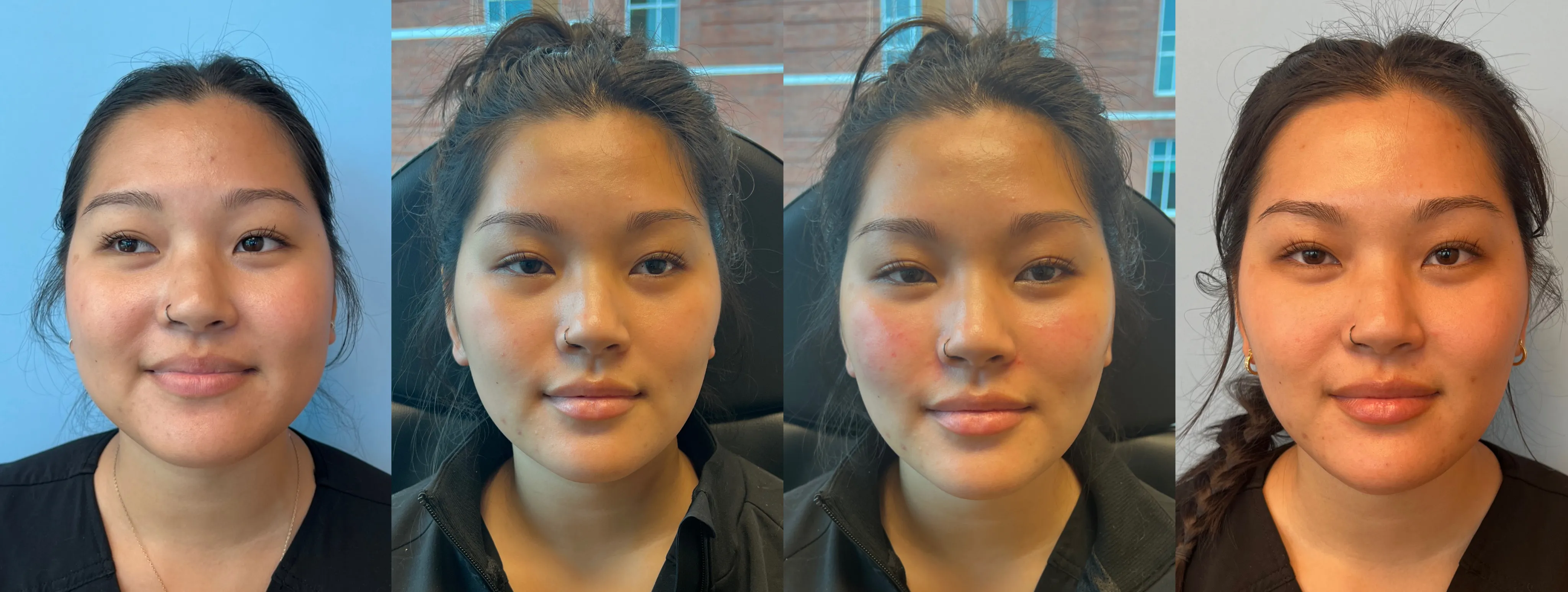 A Year of Transformation: Caitlin’s Journey to Balance & Natural Beauty