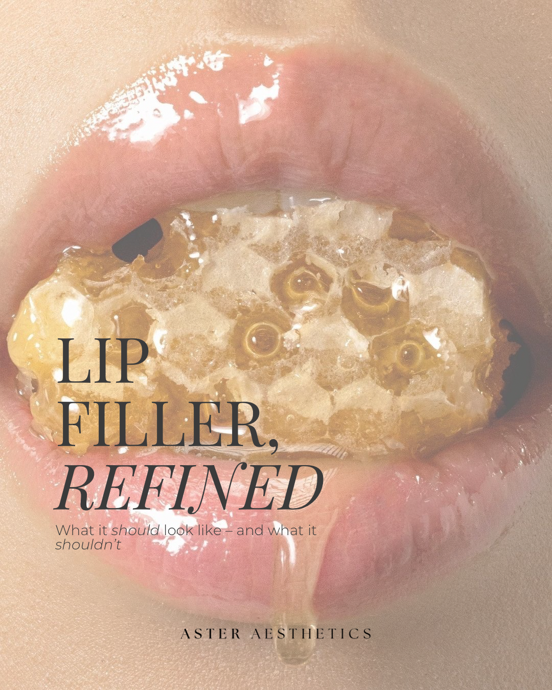 Why “Less” Is Often More in Lip Filler: A Modern Approach to Natural Results